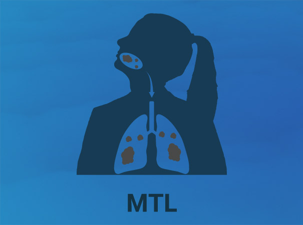 MTL - Mouth to Lung Vaping